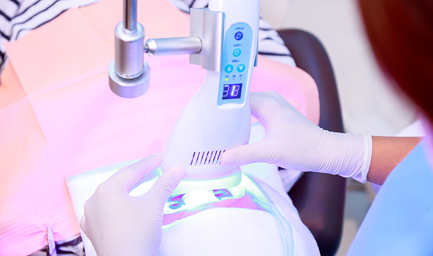 オフィスホワイトニング